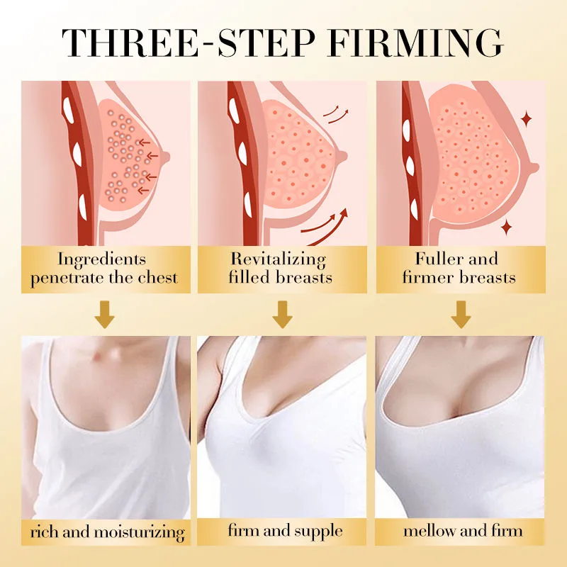 After BreastWoo